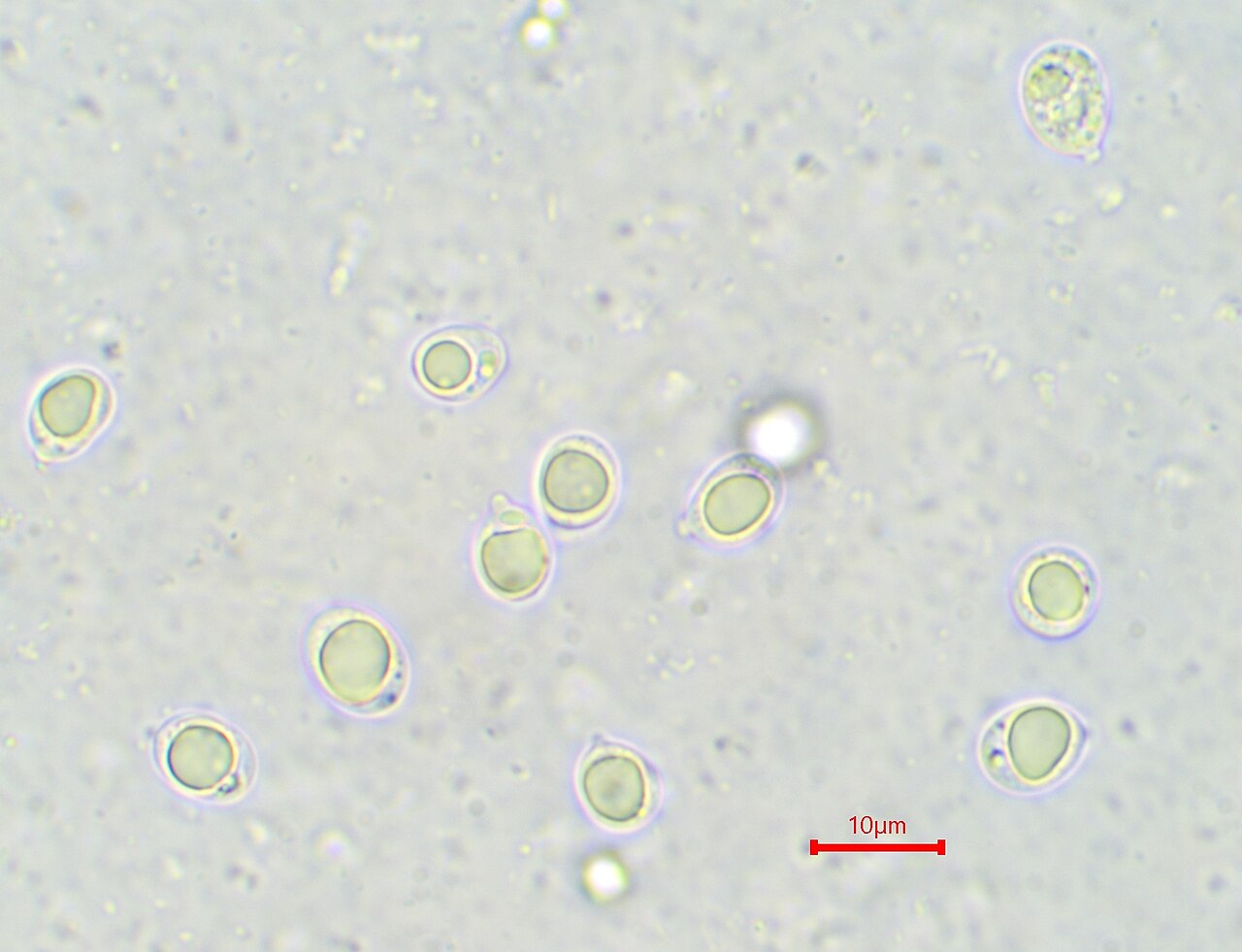 Češerasta muhara – Amanita strobiliformis