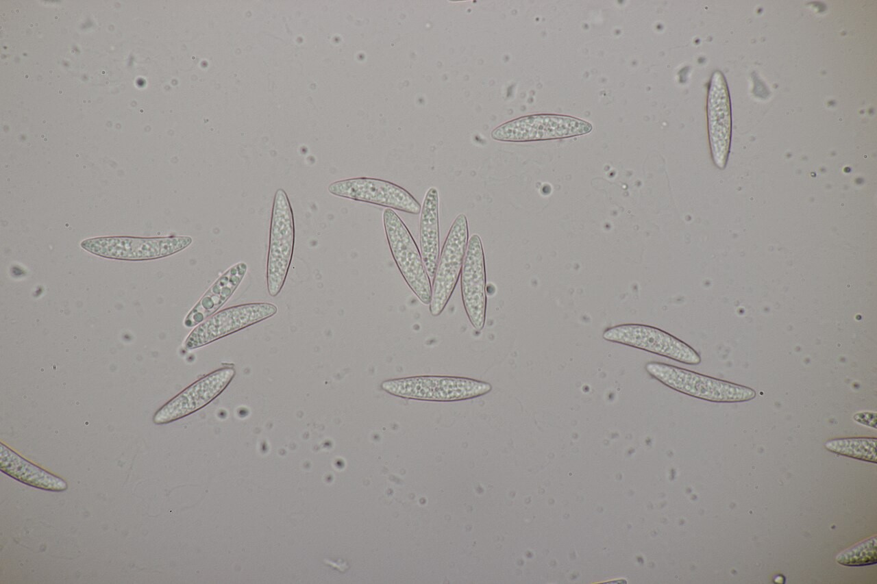 Vijoličasta želatinka – Ascocoryne cylichnium