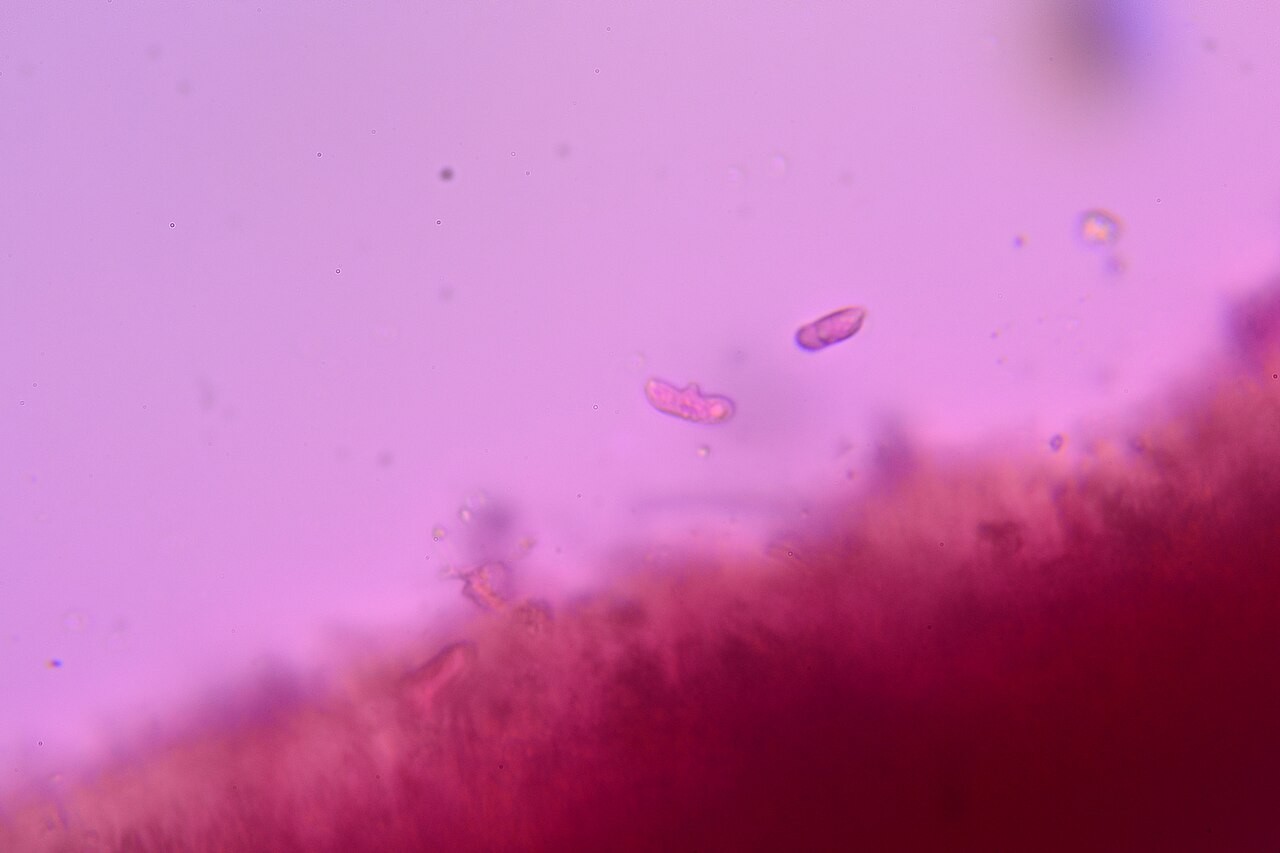Brestova uška – Auricularia mesenterica