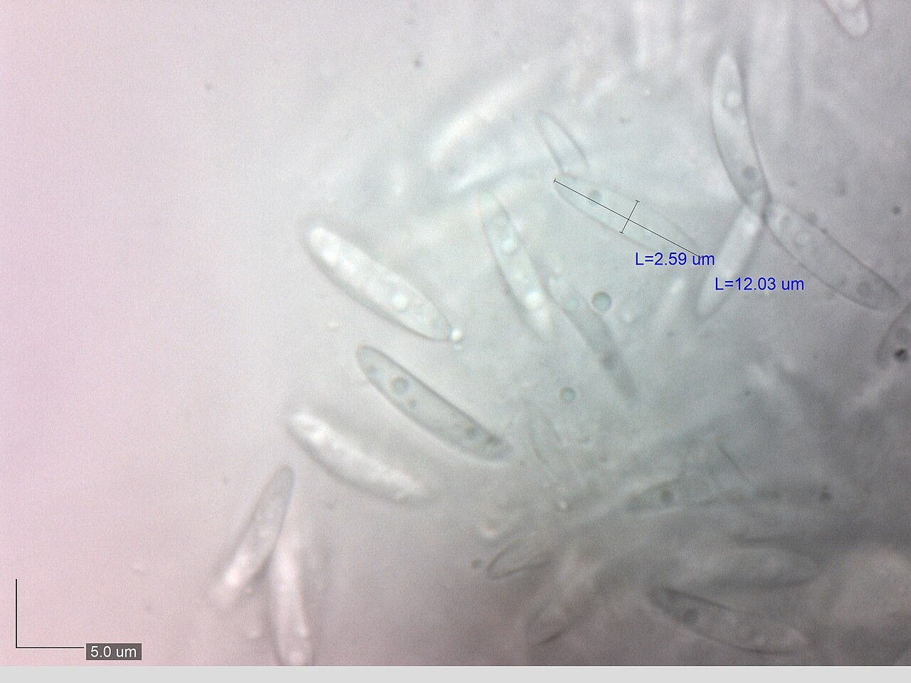 Zeleni zelenivec – Chlorociboria aeruginosa